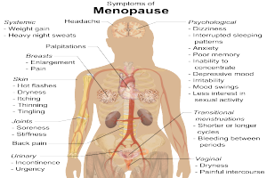 Ein Diagramm des menschlichen Körpers mit Etiketten, die Menopausen-Symptome wie Müdigkeit, Kopfschmerzen und Übelkeit angeben, sowie Informationen zu Ursachen, Symptomen und Behandlungen.